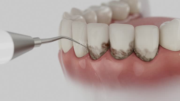 Reliable Dental contractor in Spring Ridge, MD by Dentist Open Now